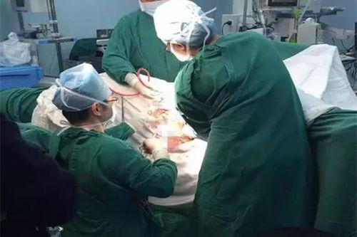 男医生给刮毛视频,专业男医生带你了解刮毛技巧